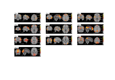 Real fMRI data example